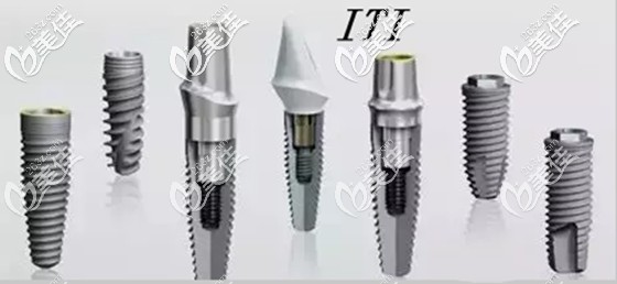 ITI种植体的起源与早期价格演变探究